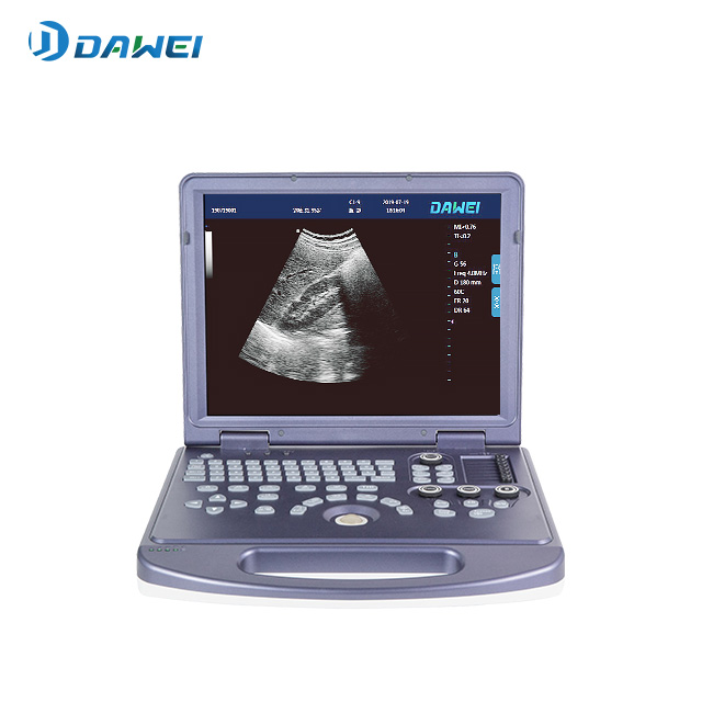Dawei DW 360 ultrasound system