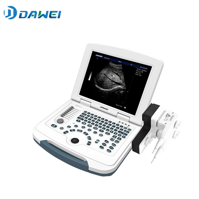 Dawei DW 580 ultrasound system