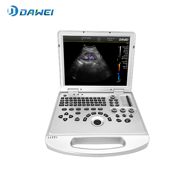 Dawei DW L3 ultrasound system