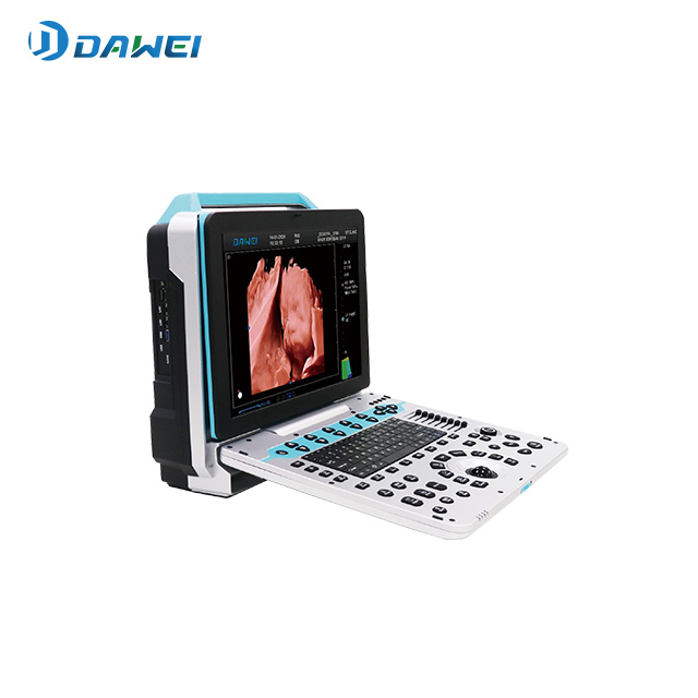 Dawei DW P50 V3.0S ultrasound system