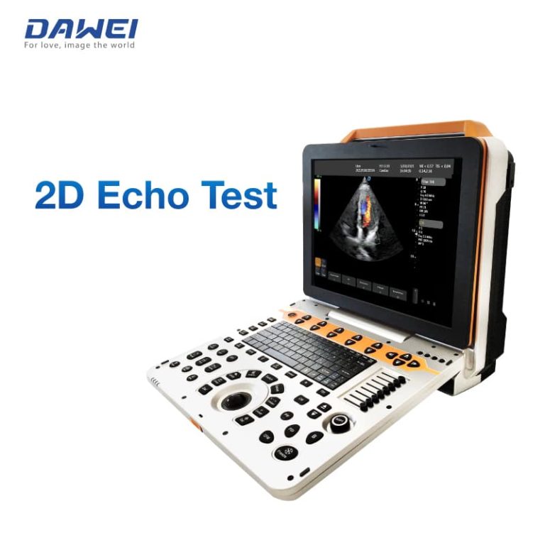 Dawei DW P60 ultrasound system
